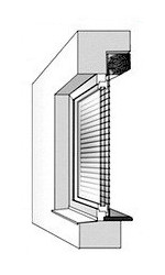 Комбинированный внутренний монтаж Комбинированный внутренний монтаж